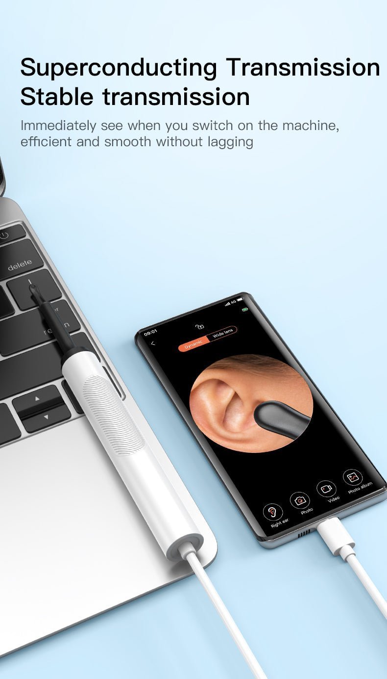 Wireless HD Ear Cleaner with Camera – Smart Otoscope Wax Removal Tool for Safe Ear Cleaning - One Stop Shop